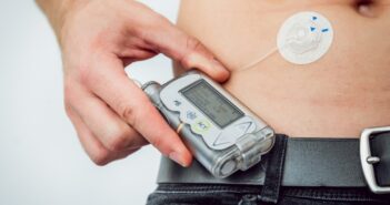 Iinsulinpumpen sorgen für nachhaltig höhere Lebensqualität (Foto: AdobeStock 229040746 romaset)